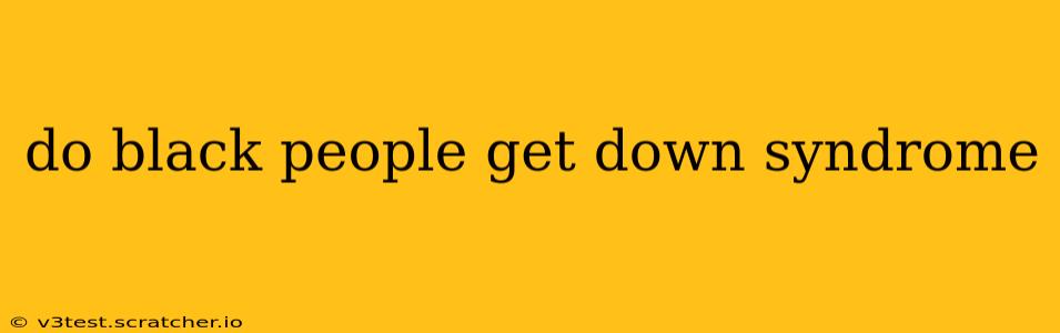 do black people get down syndrome