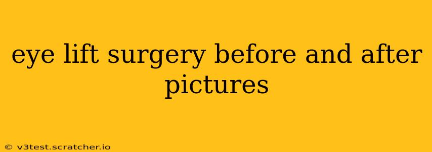 eye lift surgery before and after pictures