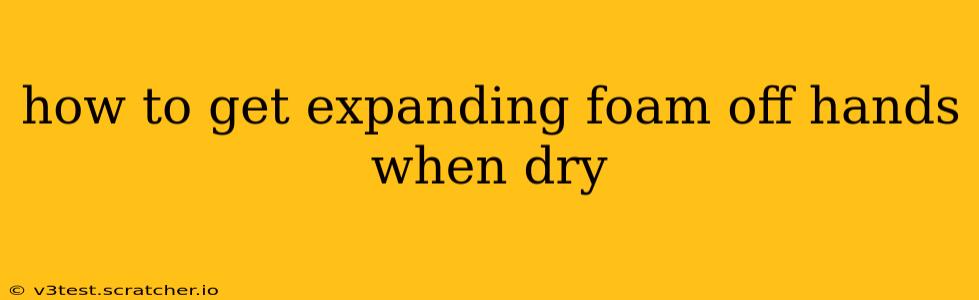 how to get expanding foam off hands when dry