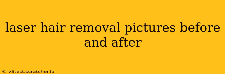laser hair removal pictures before and after