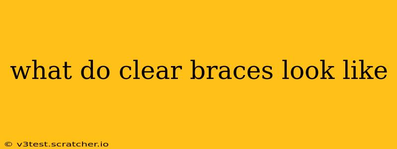 what do clear braces look like